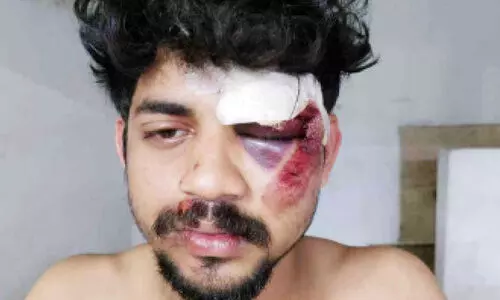 മെഡിക്കൽ കോളജിൽ ചികിത്സക്കെത്തിയ യുവാവിന്റെ പരാക്രമം; ഡോക്ടറുടെ മുഖത്തടിച്ചു