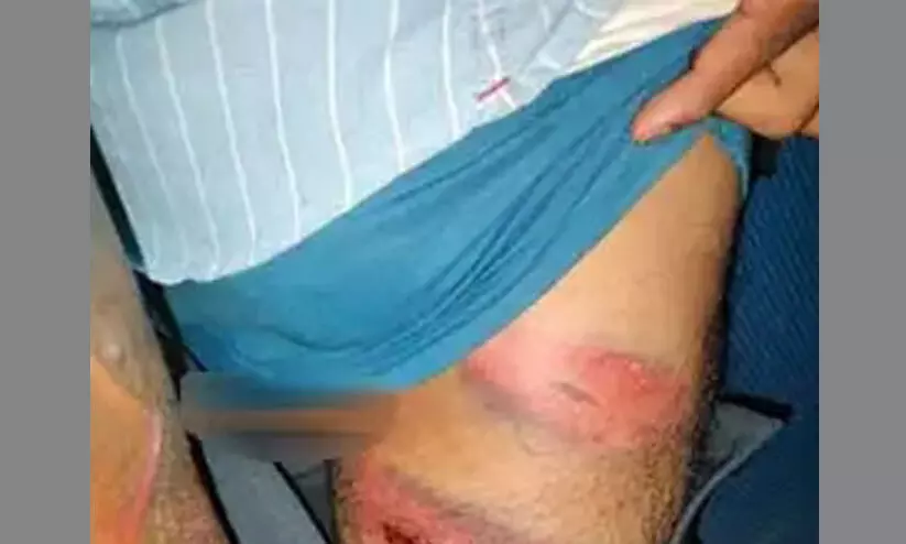 ബി.ജെ.പി നേതാക്കളെ അവഹേളിച്ച് പോസ്റ്റർ പതിച്ച പ്രവർത്തകർക്ക് പൊലീസ് കസ്റ്റഡി മർദ്ദനം