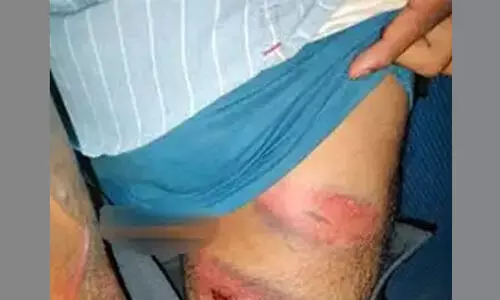 ബി.ജെ.പി നേതാക്കളെ അവഹേളിച്ച് പോസ്റ്റർ പതിച്ച പ്രവർത്തകർക്ക് പൊലീസ് കസ്റ്റഡി മർദ്ദനം