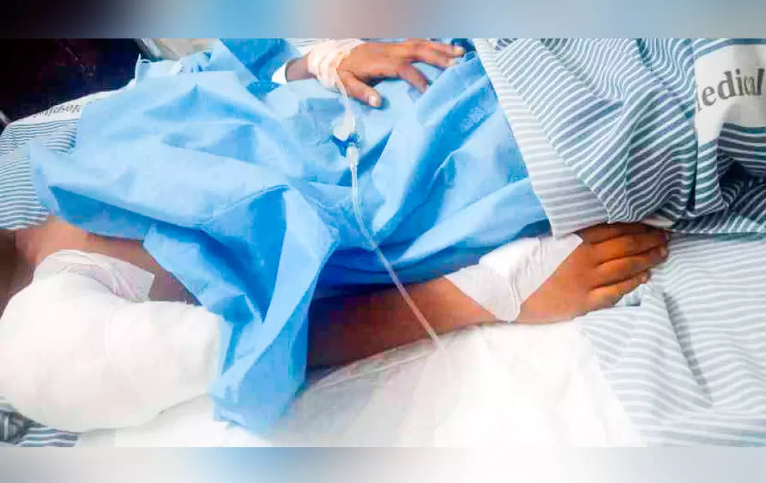 എട്ടു വയസ്സുകാരനുനേരെ വളർത്തുനായുടെ ആക്രമണം; തോളിലും കൈക്കും ഗുരുതര പരിക്ക്