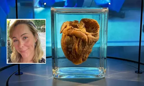 മ്യൂസിയത്തിലുള്ള തന്റെ ‘ഹൃദയം’ കാണാൻ 16 വർഷങ്ങൾക്ക് ശേഷം ജെന്നിഫർ എത്തി...