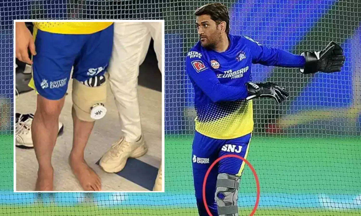 മുംബൈയിൽ കാൽമുട്ട് ശസ്ത്രക്രിയക്ക് വിധേയനായി എംഎസ് ധോണി