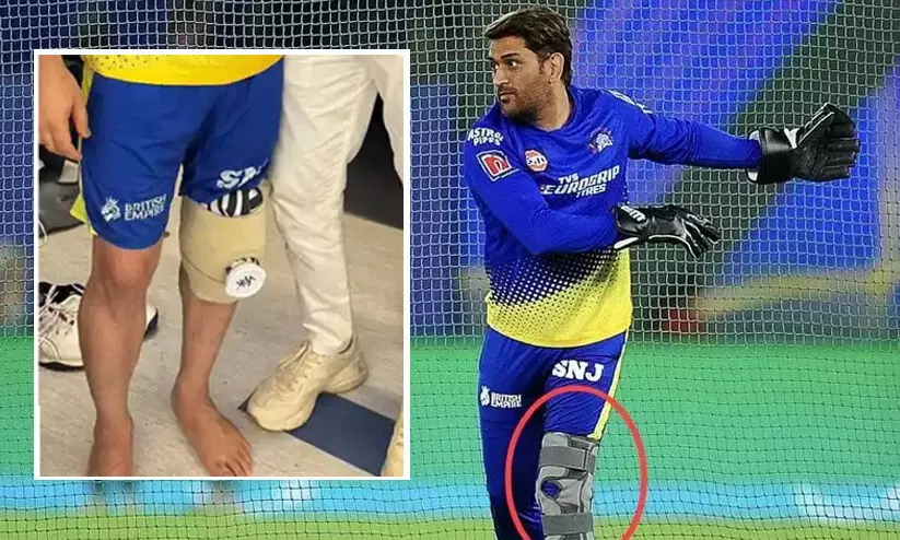 മുംബൈയിൽ കാൽമുട്ട് ശസ്ത്രക്രിയക്ക് വിധേയനായി എംഎസ് ധോണി