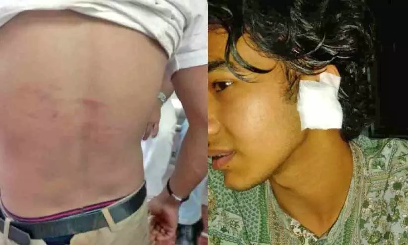 attacking case attacking case