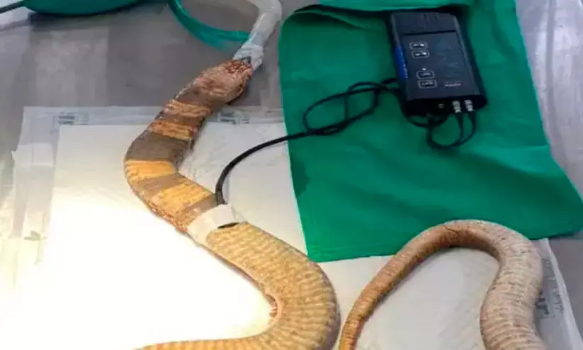 മൂ​ർ​ഖ​ന്റെ വ​യ​റ്റി​ലെ പ്ലാ​സ്റ്റി​ക് പാ​ത്രം ശ​സ്ത്ര​ക്രി​യ വ​ഴി പു​റ​ത്തെ​ടു​ത്തു