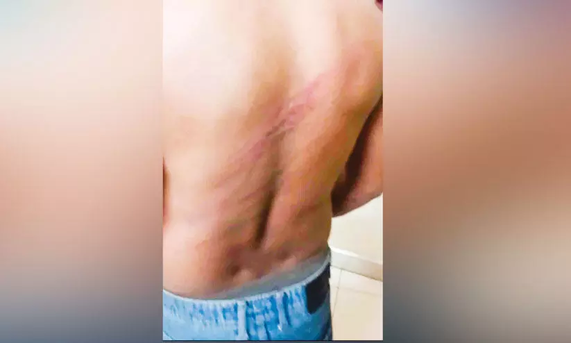 പൊലീസ് മർദിച്ചെന്ന ആരോപണവുമായി യുവാവ് പൊലീസ് മർദിച്ചെന്ന ആരോപണവുമായി യുവാവ്