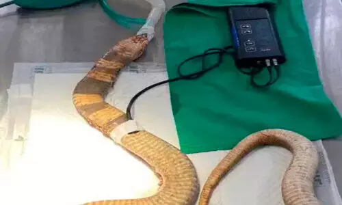 മൂ​ർ​ഖ​ന്റെ വ​യ​റ്റി​ലെ പ്ലാ​സ്റ്റി​ക് പാ​ത്രം ശ​സ്ത്ര​ക്രി​യ വ​ഴി പു​റ​ത്തെ​ടു​ത്തു