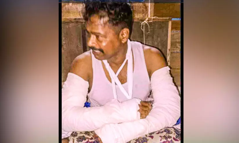 തെരുവുനായ്​ വട്ടംചാടി: റോഡിൽ വീണ ബൈക്ക് യാത്രികന്‍റെ കൈകൾ ഒടിഞ്ഞു