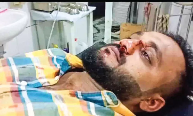 ബൈക്കിൽ പന്നിക്കൂട്ടം ഇടിച്ച് രണ്ടുപേർക്ക് പരിക്ക്