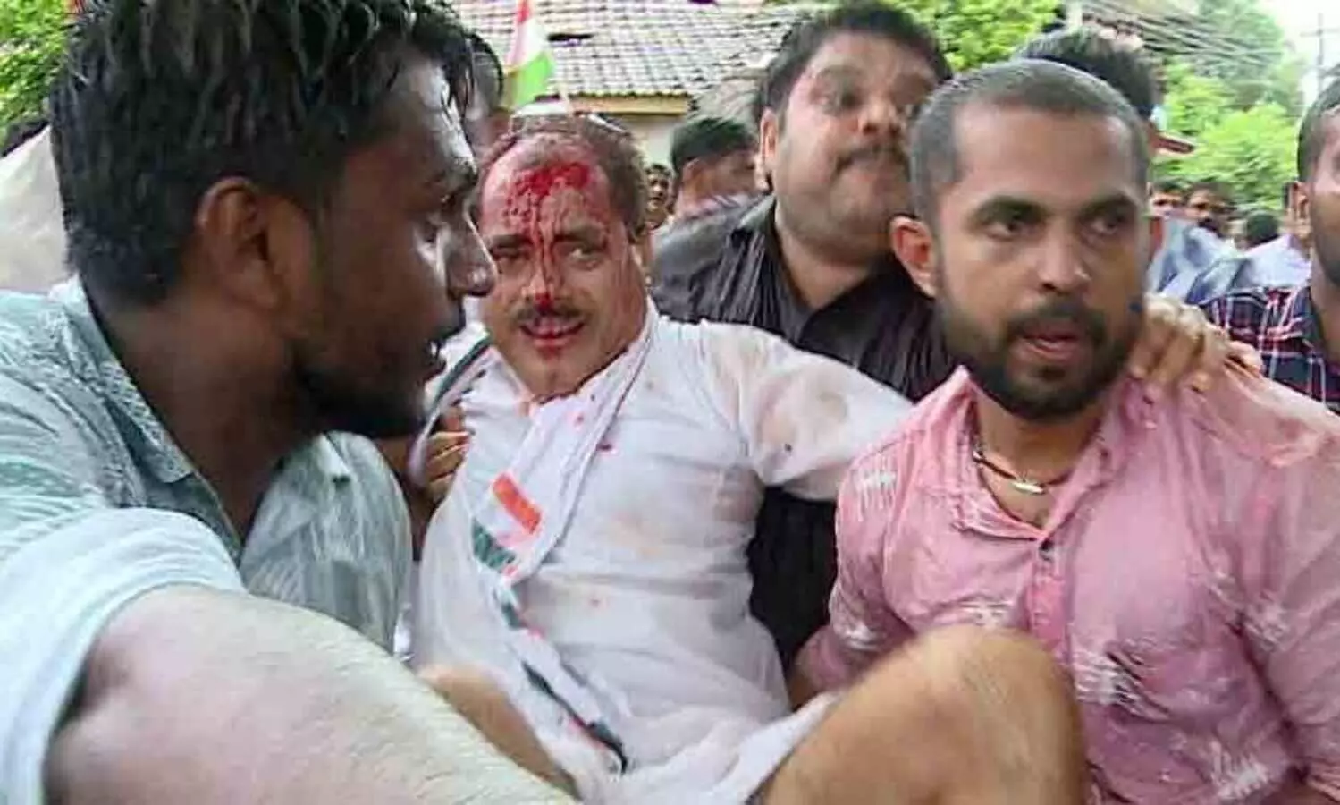 കാസർകോട്ട് ഡി.സി.സി പ്രസിഡന്റിന് തലക്ക് ലാത്തിയടിയേറ്റ് പരിക്ക്