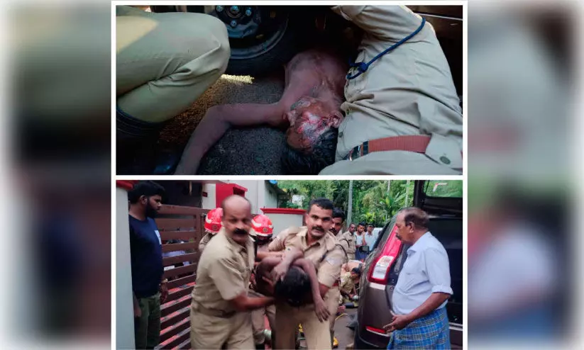 മദ്യപിച്ച് റോഡരികിൽ കിടന്നയാളുടെ കാലിലൂടെ കാർ കയറി