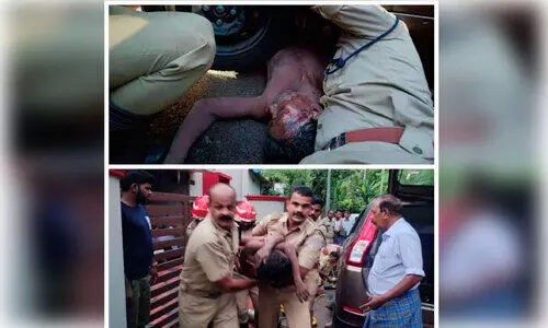 മദ്യപിച്ച് റോഡരികിൽ കിടന്നയാളുടെ കാലിലൂടെ കാർ കയറി