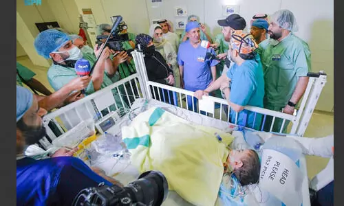 ഇഹ്​സാൻ, ബസ്സാം; സിറിയൻ സയാമീസുകളെ വിജയകരമായി വേർപ്പെടുത്തി