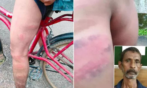 ടി.വിയുടെ റിമോട്ട് നൽകിയില്ല; ഭിന്നശേഷിക്കാരനെ ക്രൂരമായി മർദിച്ച പിതാവ് അറസ്റ്റിൽ ടി.വിയുടെ റിമോട്ട് നൽകിയില്ല; ഭിന്നശേഷിക്കാരനെ ക്രൂരമായി മർദിച്ച പിതാവ് അറസ്റ്റിൽ