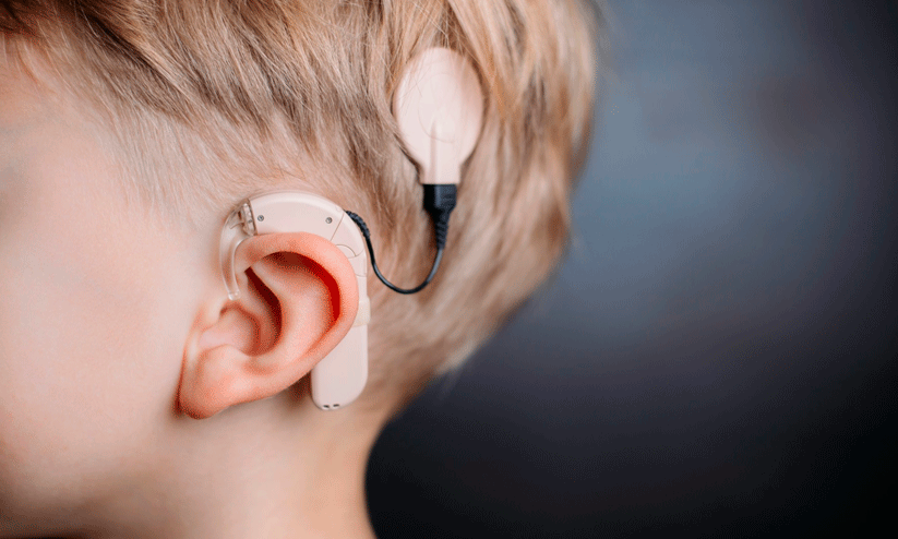 Cochlear implant