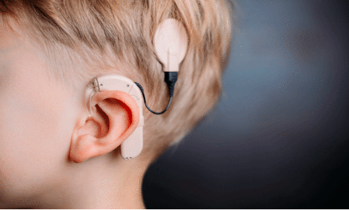 Cochlear implant