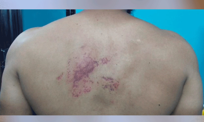 വഴിയോര കച്ചവടക്കാരന് ക്രൂരമർദനം വഴിയോര കച്ചവടക്കാരന് ക്രൂരമർദനം