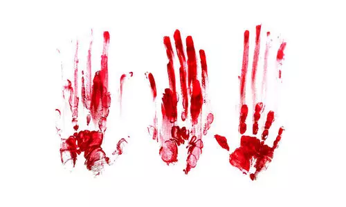 നിങ്ങളിൽ ഇത്​ ഒരു ​െഞട്ടലും ഉണ്ടാക്കുന്നില്ലേ?