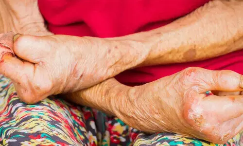 കോ​ട്ട​യം ജില്ലയിൽ കഴിഞ്ഞവർഷം കുഷ്​ഠരോഗം ബാധിച്ചത്​ 29 പേർക്ക്​