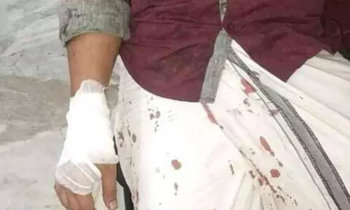 തെരുവുനായ് കുറുകെ ചാടി; രണ്ട് ബൈക്ക് യാത്രികര്‍ക്ക് പരിക്ക്