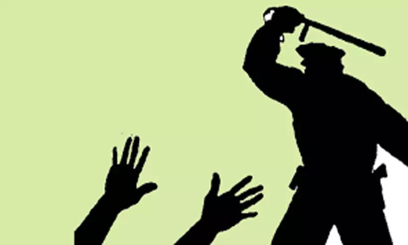 രണ്ടു വർഷത്തിനിടെ സംസ്ഥാനത്ത് 83 കസ്റ്റഡി മരണം