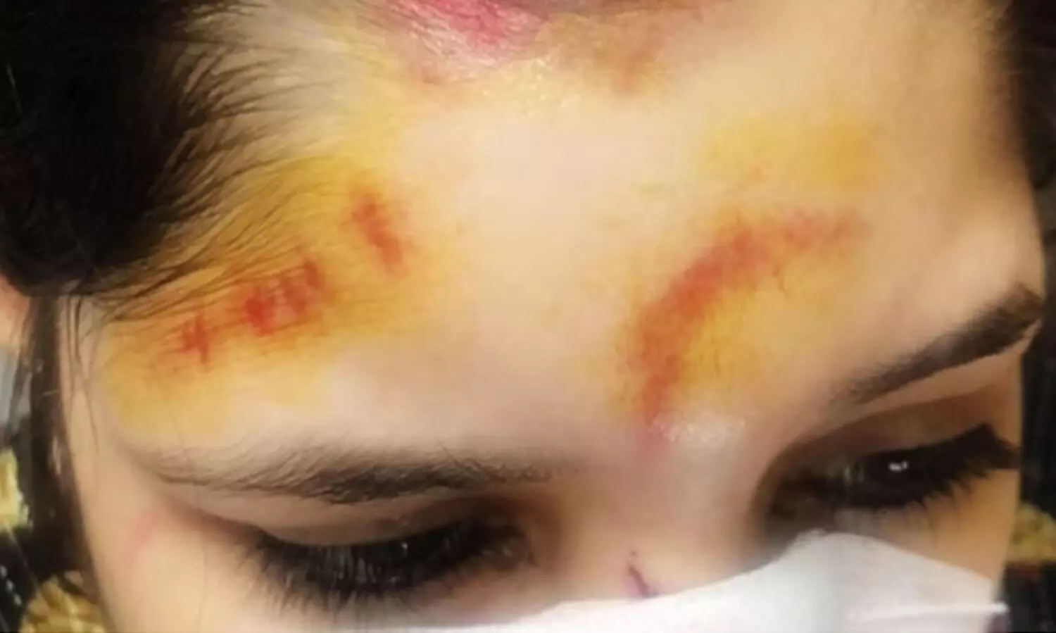 ഡൽഹിയിൽ ഓട്ടോയിൽ സഞ്ചരിക്കവെ സ്കൂൾ അദ്ധ്യാപികയുടെ ഐഫോൺ തട്ടിപ്പറിച്ചു