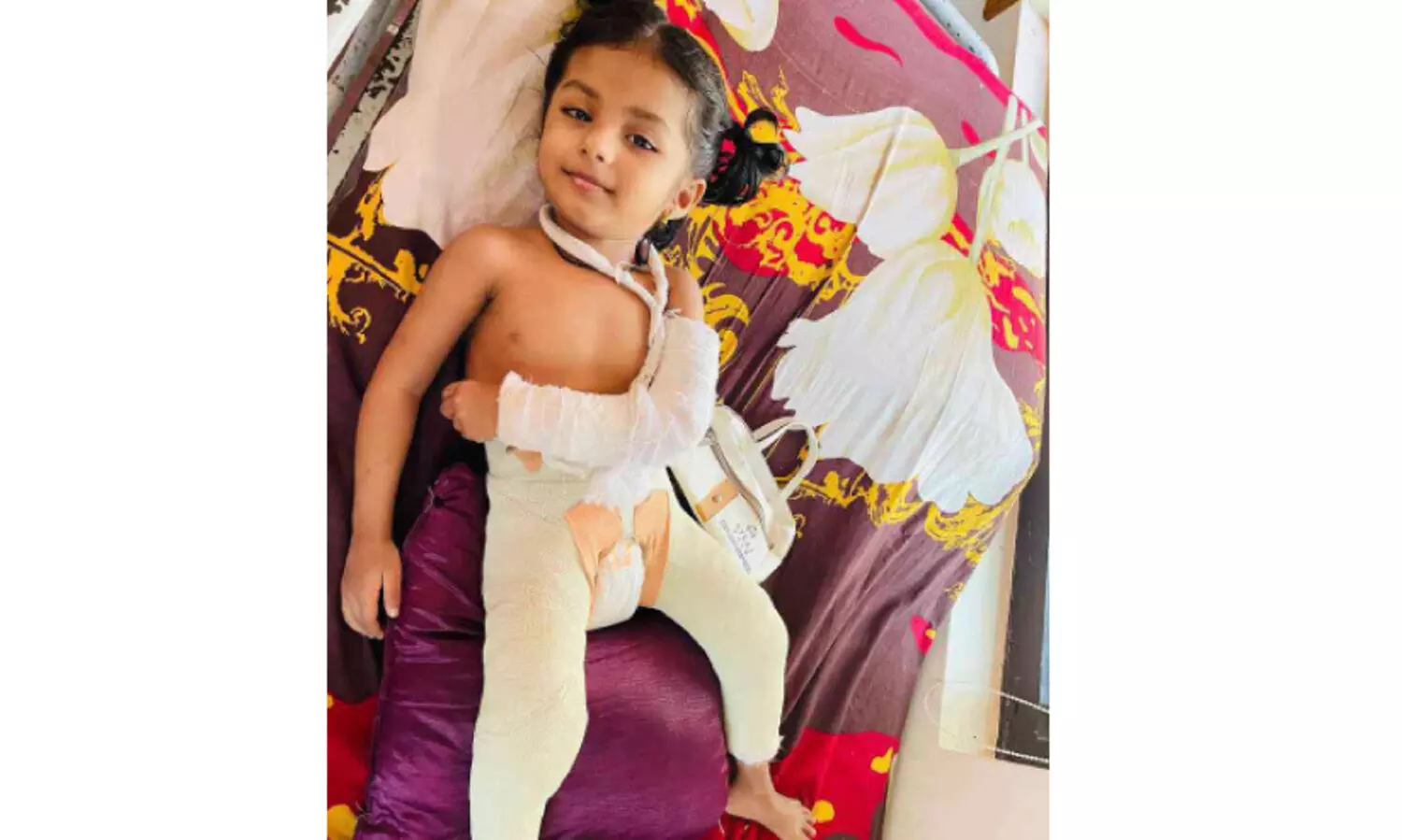 എല്ലുകൾ നുറുങ്ങുന്ന വേദനയിൽ ഫസ്ന ഫാത്തിമ; ആ പുഞ്ചിരി മായാതിരിക്കാൻ നാട് ​കൈകോർക്കുന്നു