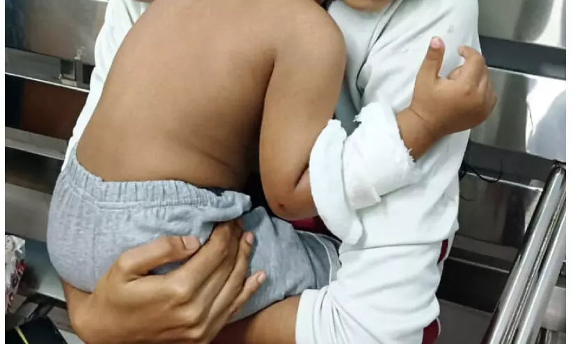 കു​ന്ന​ത്തൂ​രി​ൽ ഒ​ന്ന​ര വ​യ​സ്സു​കാ​ര​ന് തെ​രു​വു​നാ​യു​ടെ ക​ടി​യേ​റ്റു