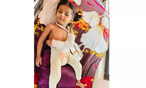 എല്ലുകൾ നുറുങ്ങുന്ന വേദനയിൽ ഫസ്ന ഫാത്തിമ; ആ പുഞ്ചിരി മായാതിരിക്കാൻ നാട് ​കൈകോർക്കുന്നു