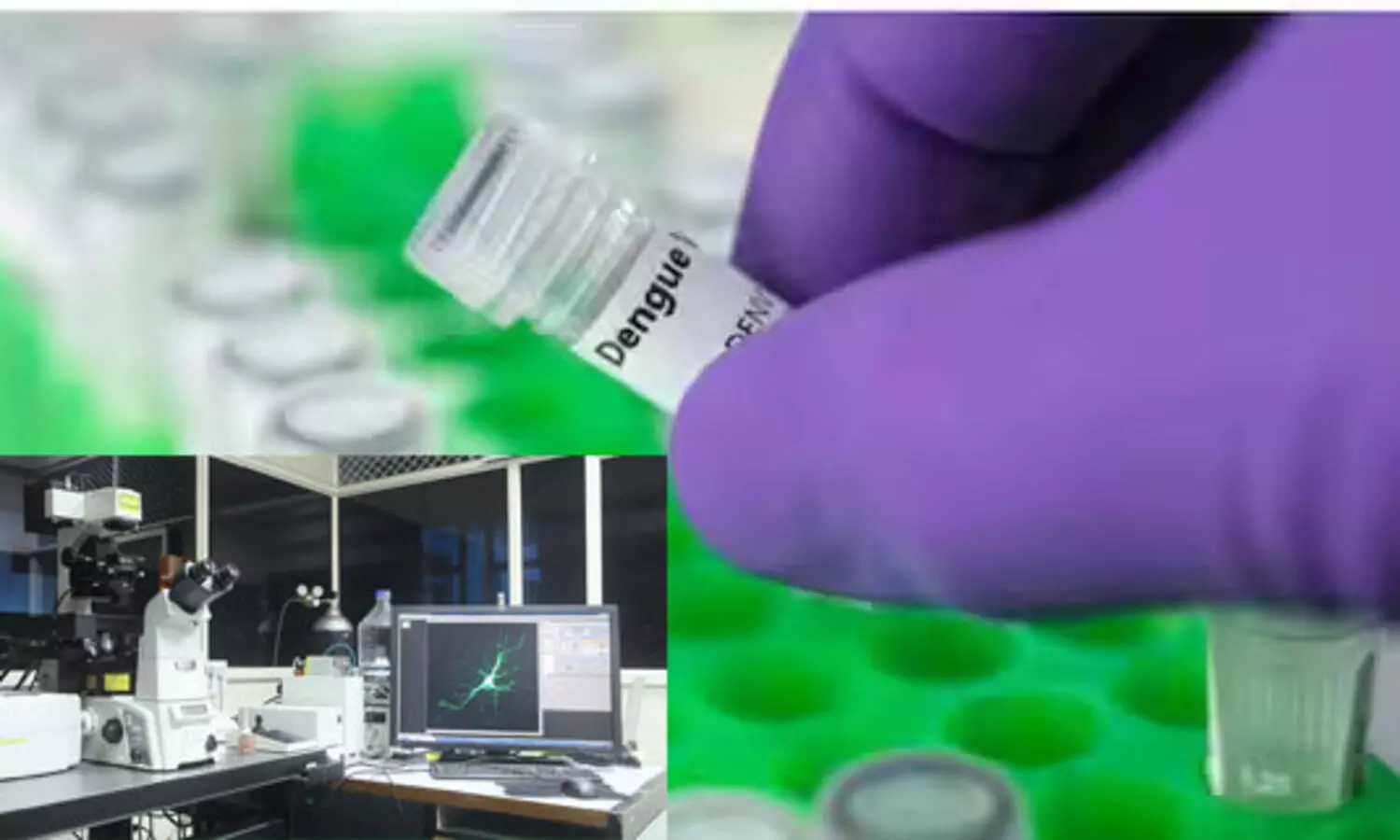 ഉയര്‍ന്ന അന്തരീക്ഷ താപനിലയില്‍ വളരുന്ന ഡെങ്കി വൈറസ് മാരകമാകാമെന്ന് ആർ.ജി.സി.ബി പഠനം