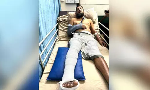 കാട്ടുപന്നി സ്‌കൂട്ടറിനുമുന്നിൽ ചാടി; യാത്രക്കാരന് ഗുരുതര പരിക്ക്