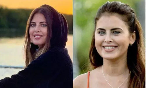 പ്ലാസ്റ്റിക് സർജറിയെ തുടർന്ന് അർജന്റീനിയൻ നടി സിൽവിന ലൂണ അന്തരിച്ചു