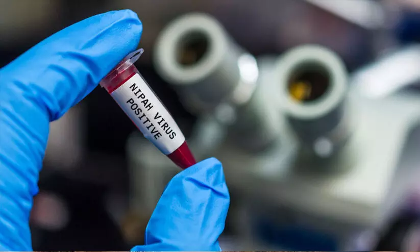 nipah virus