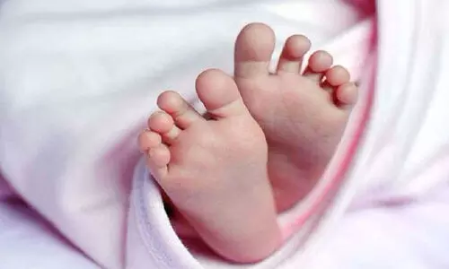 representational image