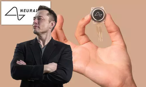 ന്യൂറാലിങ്കിന്റെ ചിപ്പ് തലച്ചോറിൽ ഘടിപ്പിക്കാൻ തയ്യാറുണ്ടോ..? രജിസ്ട്രേഷൻ തുടങ്ങി മസ്കിന്റെ കമ്പനി