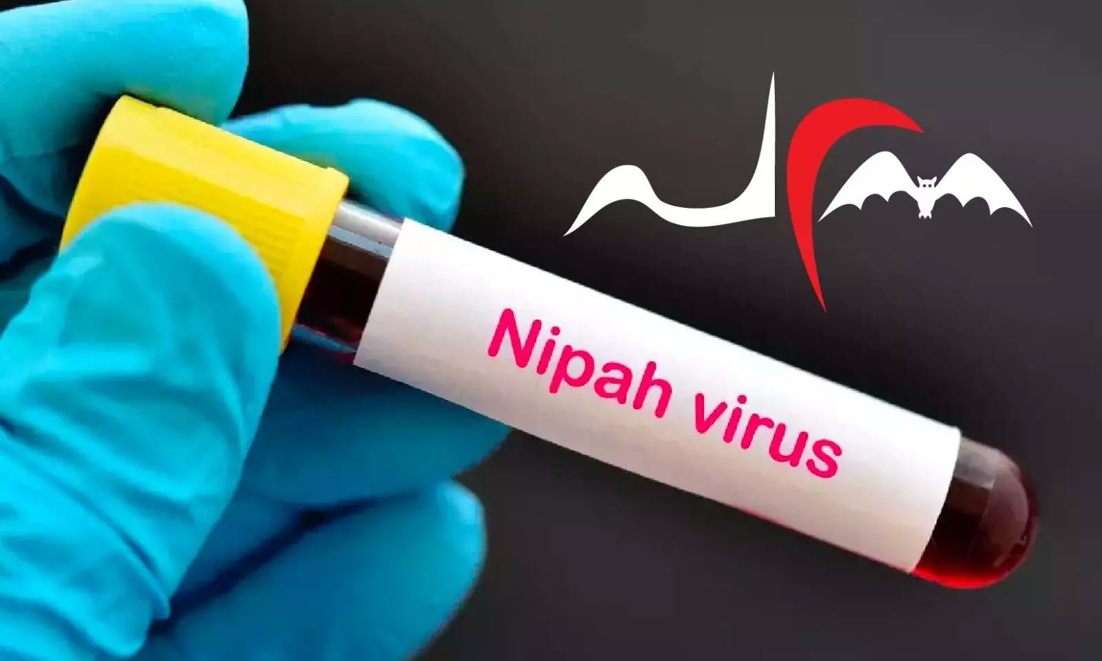 Nipah 2023