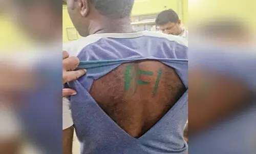 സൈനികന്റെ മുതുകിൽ പി.എഫ്.ഐ എന്നെഴുതിയെന്ന്; മൊഴിയിൽ വൈരുധ്യമുണ്ടെന്ന് പൊലീസ് സൈനികന്റെ മുതുകിൽ പി.എഫ്.ഐ എന്നെഴുതിയെന്ന്; മൊഴിയിൽ വൈരുധ്യമുണ്ടെന്ന് പൊലീസ്