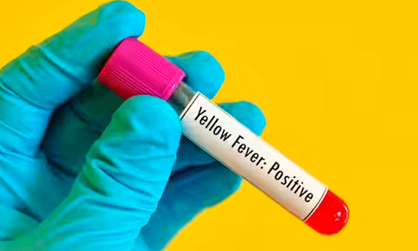 മഞ്ഞപ്പിത്തം മഞ്ഞപ്പിത്തം