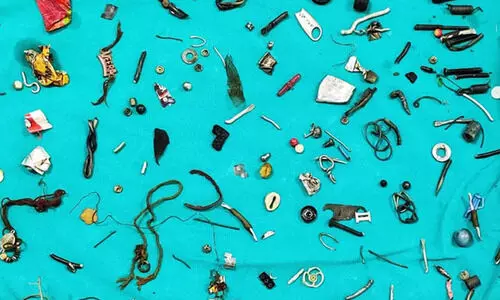 സ്ഥിരമായി വയറു വേദന: എക്സ്റേ കണ്ട ഡോക്ടർമാർ വയറ്റിലെ സാധനങ്ങൾ കണ്ട് ഞെട്ടി