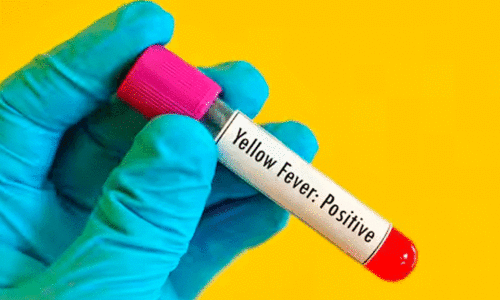 മഞ്ഞപ്പിത്തം