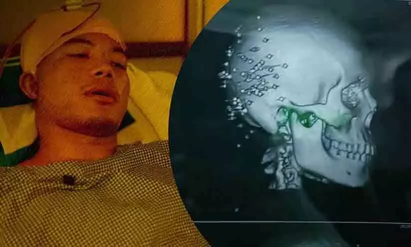 മണിപ്പൂർ സംഘർഷത്തിൽ വുഷു കളിക്കാരന് പരിക്ക്