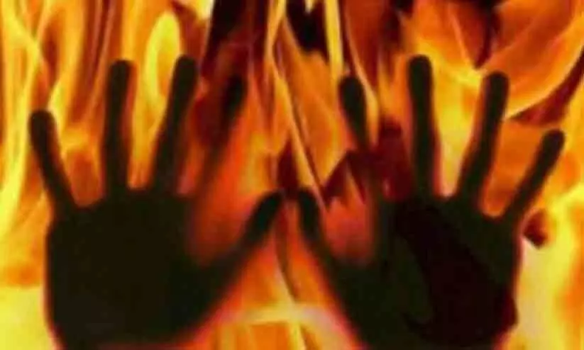 Burned to death Burned to death