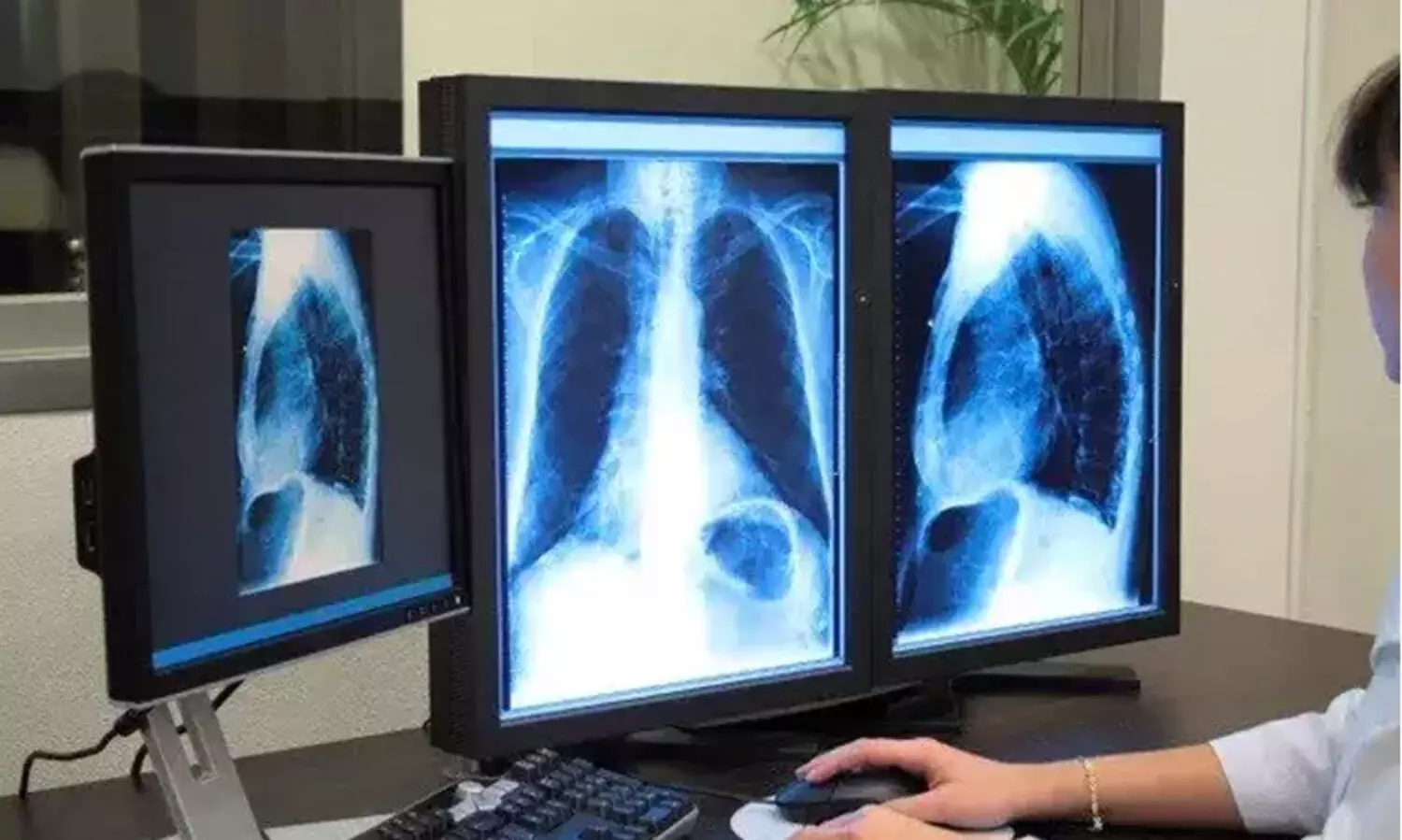 റേഡിയോളജിസ്റ്റ് തസ്തികയിൽ താൽക്കാലിക നിയമനം