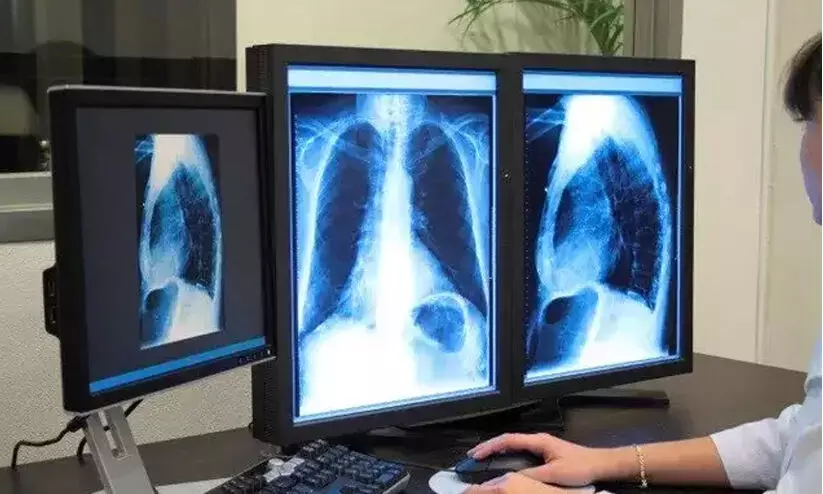 റേഡിയോളജിസ്റ്റ് തസ്തികയിൽ താൽക്കാലിക നിയമനം