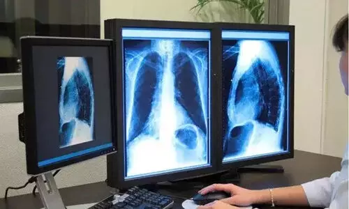 റേഡിയോളജിസ്റ്റ് തസ്തികയിൽ താൽക്കാലിക നിയമനം