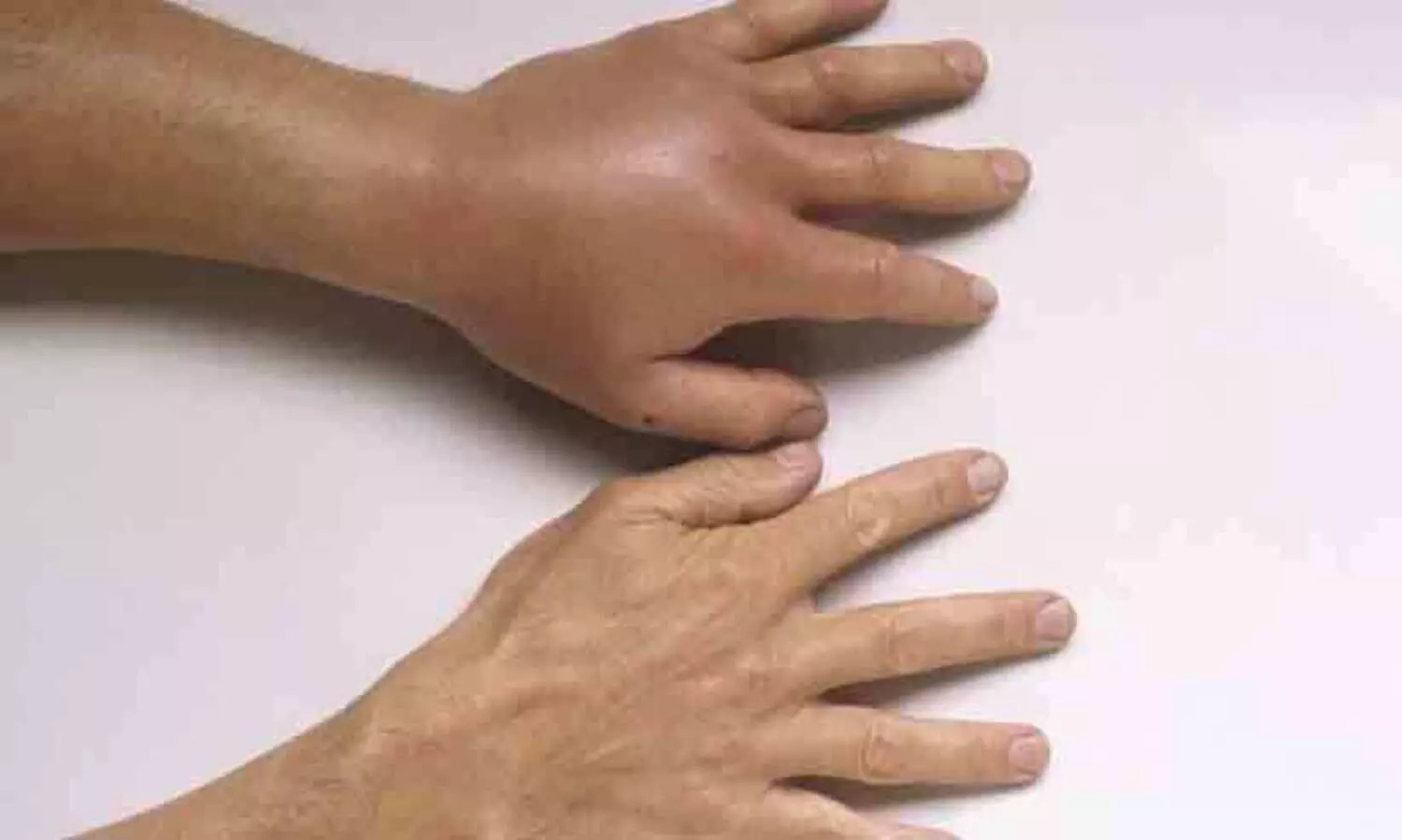 തൃക്കളയൂരിൽ കടന്നൽ കുത്തേറ്റു സ്ത്രീക്ക് പരിക്ക്