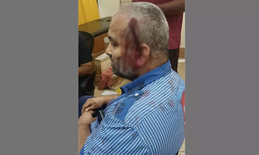 ഫോൺ ഓഫ് ചെയ്യാൻ ആവശ്യപ്പെട്ട പെട്രോൾ പമ്പ് ജീവനക്കാരനെ ആക്രമിച്ചു