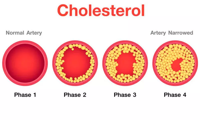 cholesterol