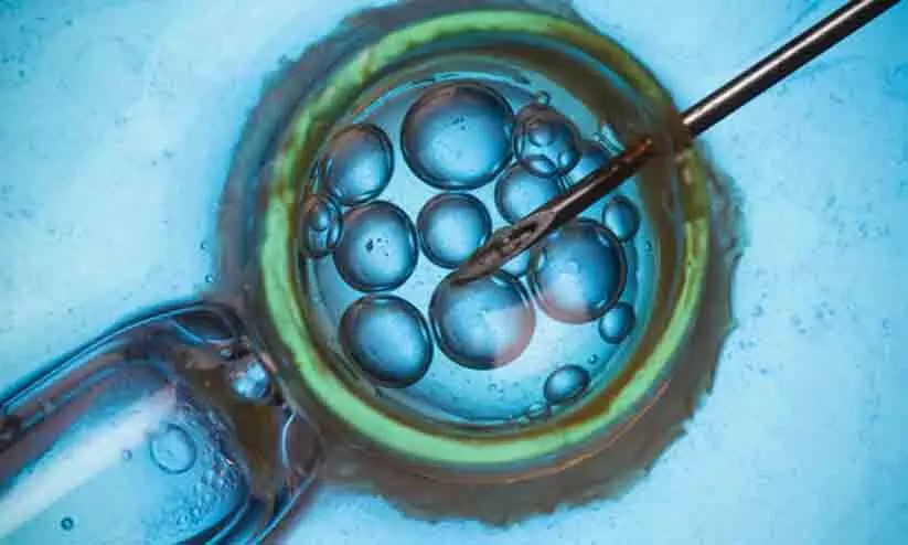 രഹസ്യമായി സ്വന്തം ബീജം വന്ധ്യത ചികിത്സക്ക് ഉപയോഗിച്ചു; 34 വർഷം മുമ്പ് ചികിത്സിച്ച ഡോക്ടർക്കെതിരെ കേസ് നൽകി യു.എസ് യുവതി രഹസ്യമായി സ്വന്തം ബീജം വന്ധ്യത ചികിത്സക്ക് ഉപയോഗിച്ചു; 34 വർഷം മുമ്പ് ചികിത്സിച്ച ഡോക്ടർക്കെതിരെ കേസ് നൽകി യു.എസ് യുവതി