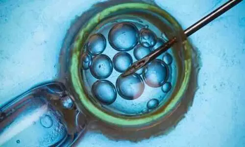 രഹസ്യമായി സ്വന്തം ബീജം വന്ധ്യത ചികിത്സക്ക് ഉപയോഗിച്ചു; 34 വർഷം മുമ്പ് ചികിത്സിച്ച ഡോക്ടർക്കെതിരെ കേസ് നൽകി യു.എസ് യുവതി രഹസ്യമായി സ്വന്തം ബീജം വന്ധ്യത ചികിത്സക്ക് ഉപയോഗിച്ചു; 34 വർഷം മുമ്പ് ചികിത്സിച്ച ഡോക്ടർക്കെതിരെ കേസ് നൽകി യു.എസ് യുവതി